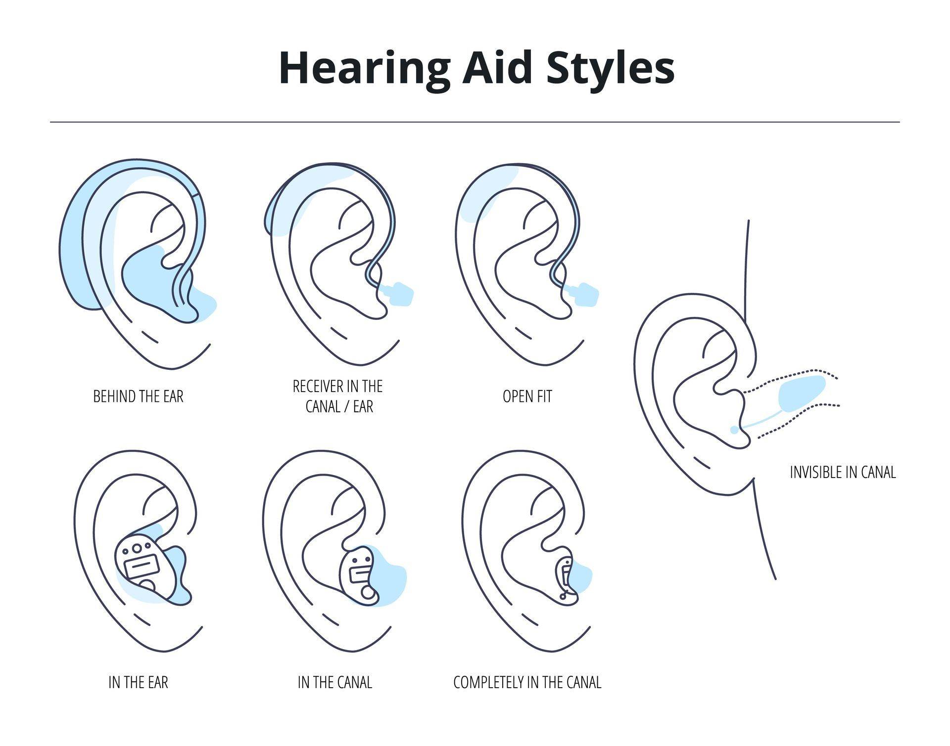 Cochlear Implant vs Hearing Aids What’s the Difference? The Hearing Room